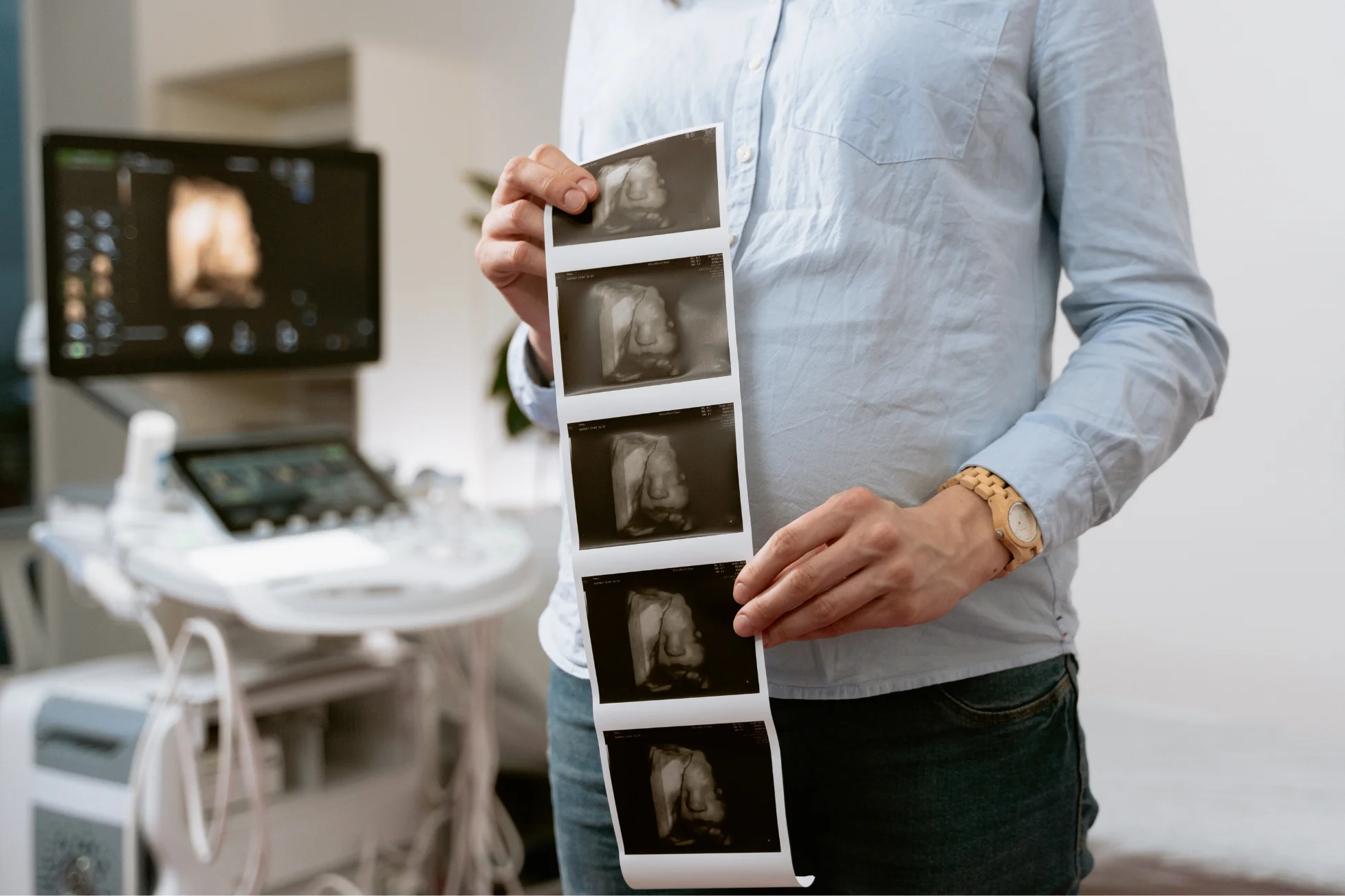 Baby Brain Ultrasound